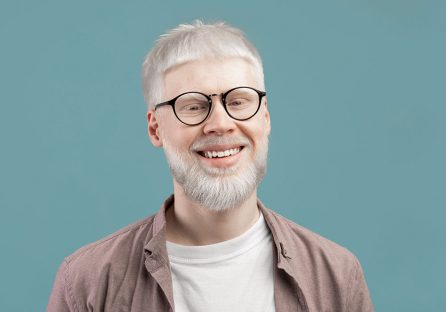 Personas con albinismo